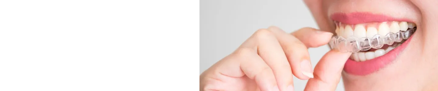 Donna utilizza apparecchio dentale trasparente per odontoiatria a Centro Medico Europeo Cuneo.